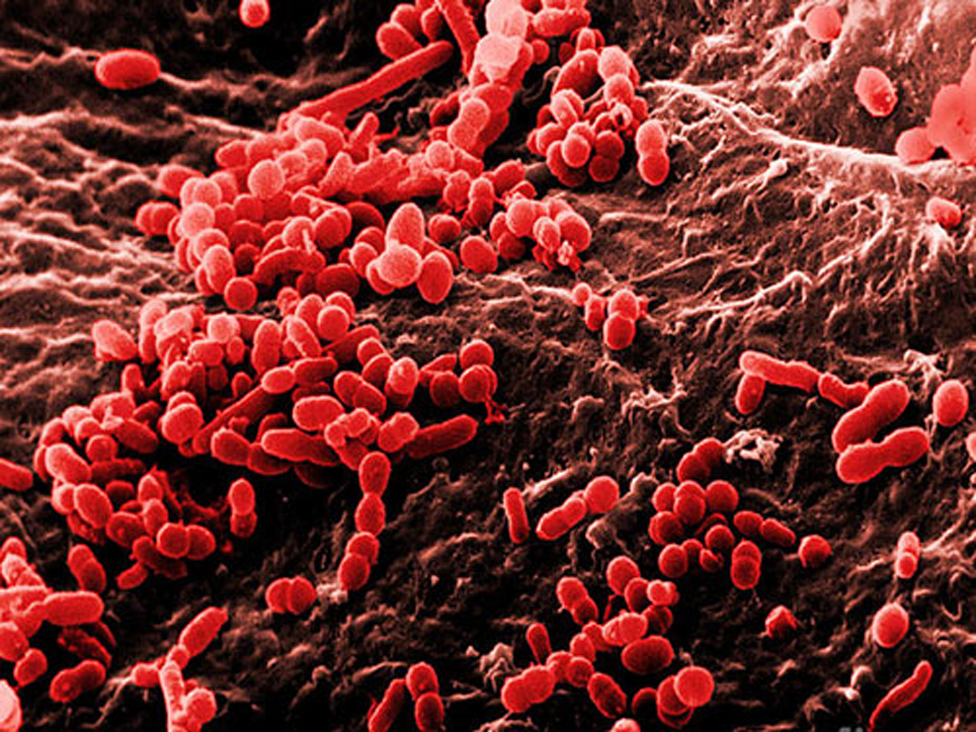 Kingdom Of Bacteria   Armatimonadetes Chthonomonas Calidirosea 