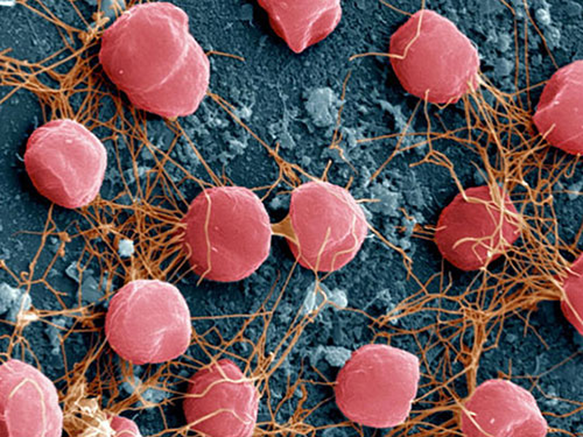 Organisms Archaea Pyrolobus Fumarii Pictures Images