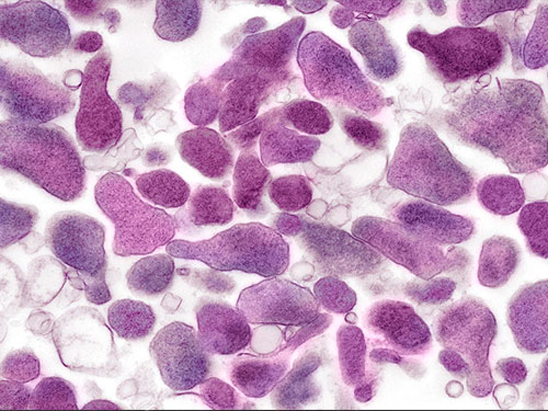 Mycoplasma pneumoniae. Микоплазма микроскопия. Урогенитальный микоплазмоз микробиология. Уреаплазма уреалитикум микробиология.